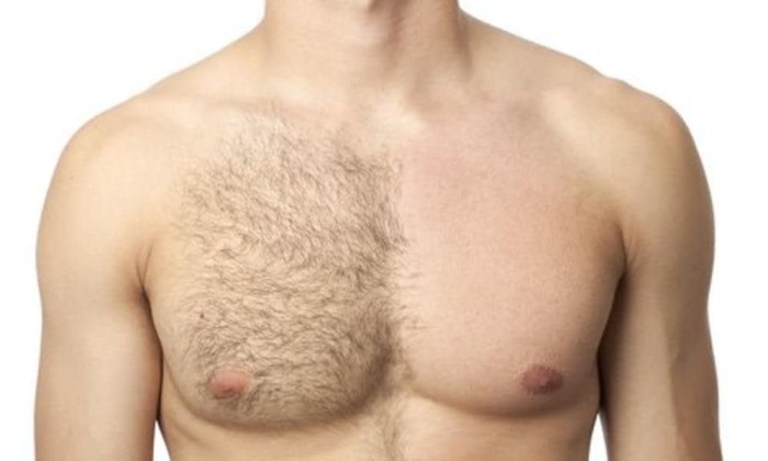 BUSCO ESTETICISTA PARA DEPILARME CON CERA profile photo